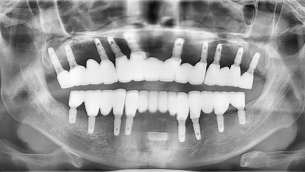 치료 후 이미지